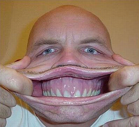 operatii plastice facelift marire sani